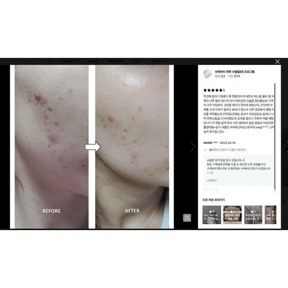 BRAVITY Derma Stemcell 35 Program (K-Beauty)